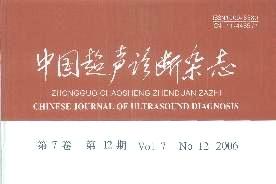 中国超声诊断
